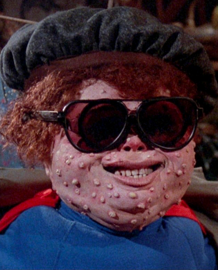 Personnage grotesque du film The Garbage Pail Kids Movie (1987), portant des lunettes noires et une béret, avec un visage couvert de pustules en latex. Représentation fidèle à l’esthétique trash et caricaturale des cartes Garbage Pail Kids, adaptée ici en live action.