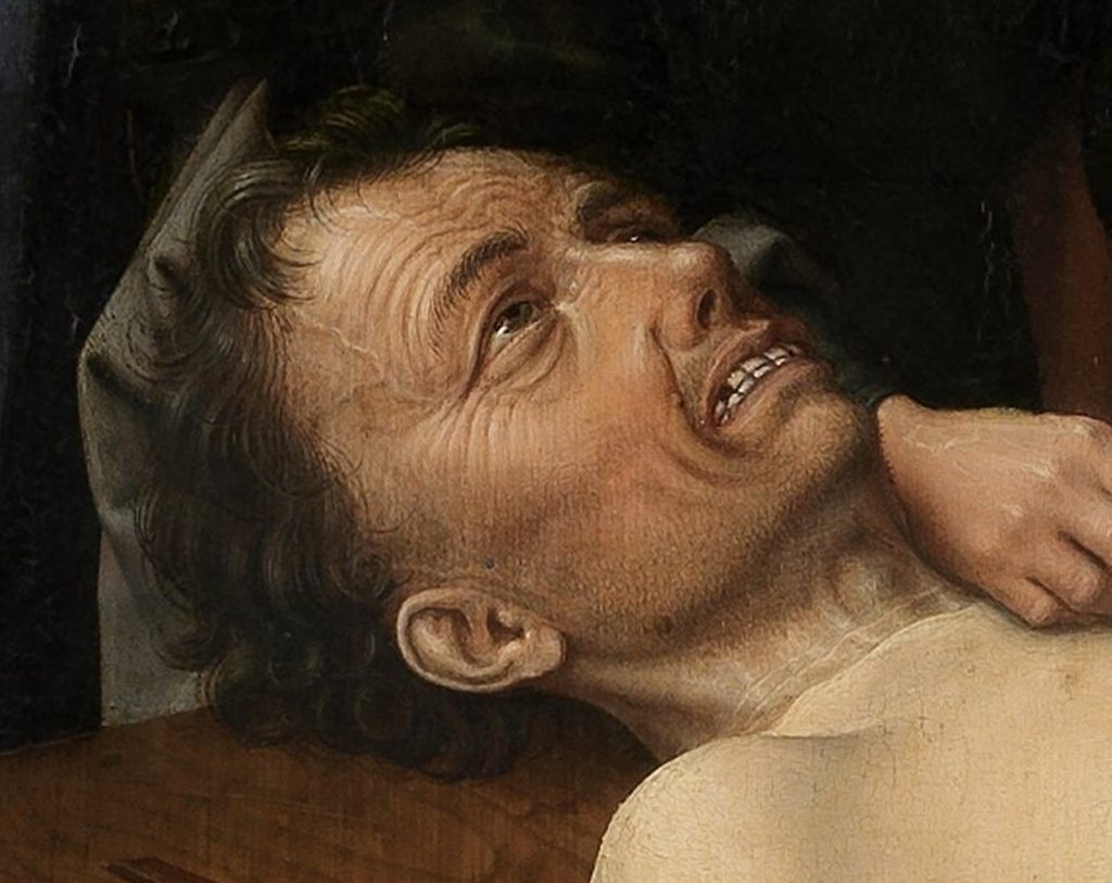 Gros plan du visage de Sisamnes dans le panneau droit du Jugement de Cambyse (Gérard David, 1498), pendant l’écorchement.